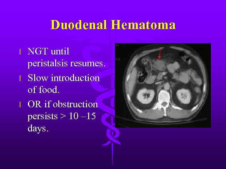 Duodenal Hematoma l l l NGT until peristalsis resumes. Slow introduction of food. OR