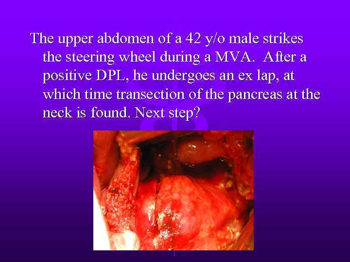 The upper abdomen of a 42 y/o male strikes the steering wheel during a