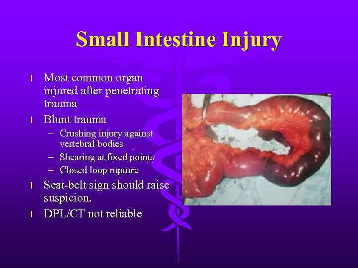 Small Intestine Injury l l Most common organ injured after penetrating trauma Blunt trauma