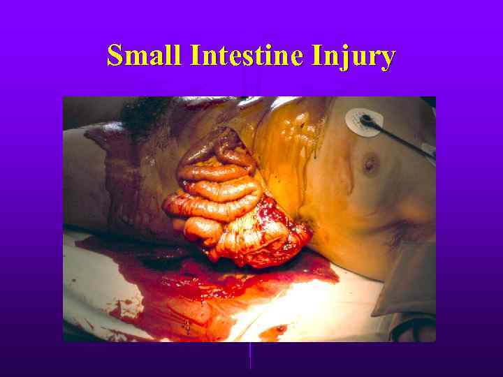 Small Intestine Injury 