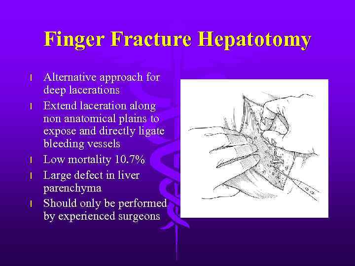 Finger Fracture Hepatotomy l l l Alternative approach for deep lacerations Extend laceration along