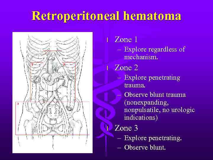 Retroperitoneal hematoma l Zone 1 – Explore regardless of mechanism. l Zone 2 –