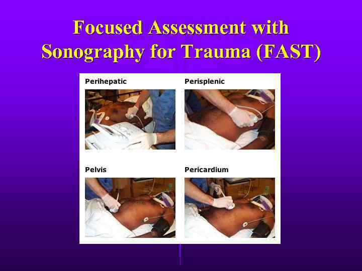 Focused Assessment with Sonography for Trauma (FAST) 