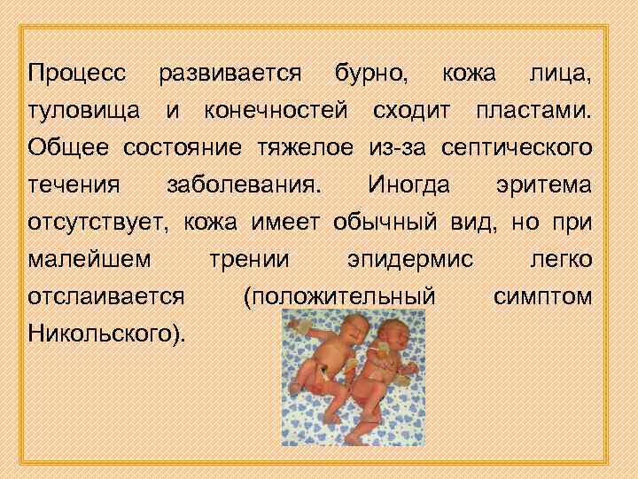 Процесс развивается бурно, кожа лица, туловища и конечностей сходит пластами. Общее состояние тяжелое из-за