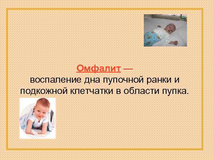 Омфалит — воспаление дна пупочной ранки и подкожной клетчатки в области пупка. 