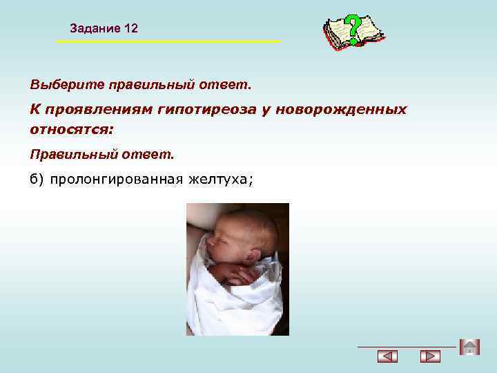 Задание 12 Выберите правильный ответ. К проявлениям гипотиреоза у новорожденных относятся: Правильный ответ. б)