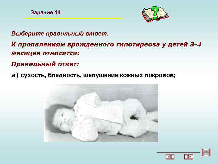 Задание 14 Выберите правильный ответ. К проявлениям врожденного гипотиреоза у детей 3 -4 месяцев