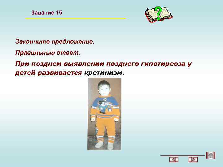 Задание 15 Закончите предложение. Правильный ответ. При позднем выявлении позднего гипотиреоза у детей развивается