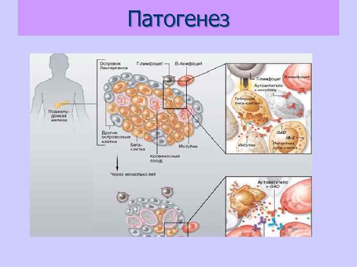 Патогенез 