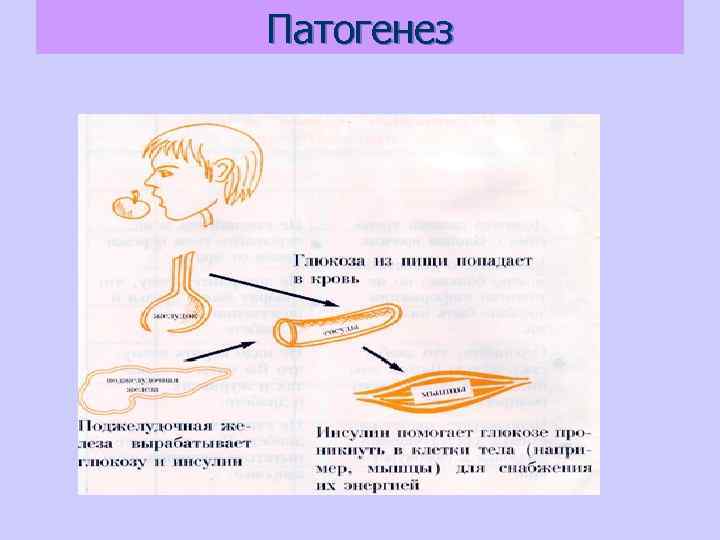 Патогенез 