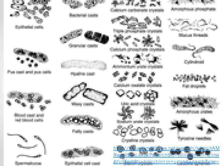 http: //accessmedicine. net/search. AM Result. Img. aspx? search. Str=bilirubin+in+urine &full. Text. Str=bilirubin+in+urine&search. Type= 