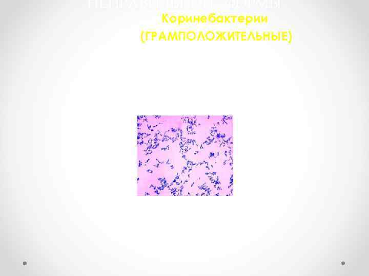 НЕПРАВИЛЬНОЙ ФОРМЫ Коринебактерии (ГРАМПОЛОЖИТЕЛЬНЫЕ) 
