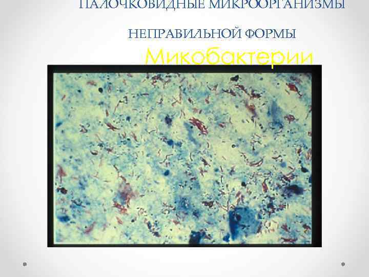 ПАЛОЧКОВИДНЫЕ МИКРООРГАНИЗМЫ НЕПРАВИЛЬНОЙ ФОРМЫ Микобактерии 
