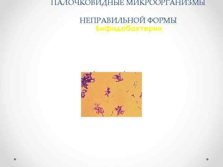 ПАЛОЧКОВИДНЫЕ МИКРООРГАНИЗМЫ НЕПРАВИЛЬНОЙ ФОРМЫ Бифидобактерии 