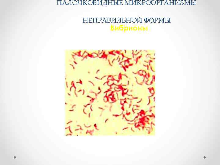 ПАЛОЧКОВИДНЫЕ МИКРООРГАНИЗМЫ НЕПРАВИЛЬНОЙ ФОРМЫ Вибрионы 
