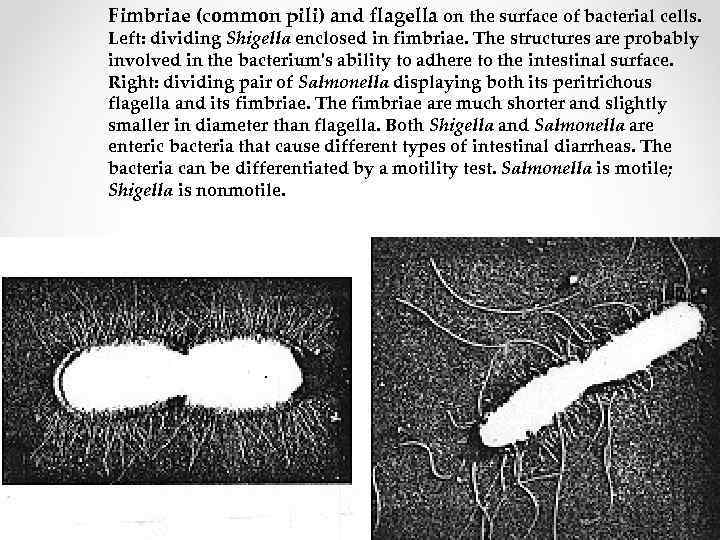 Фимбрии бактерий картинки