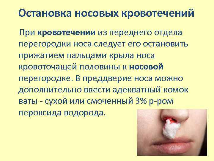 Остановка носовых кровотечений При кровотечении из переднего отдела перегородки носа следует его остановить прижатием