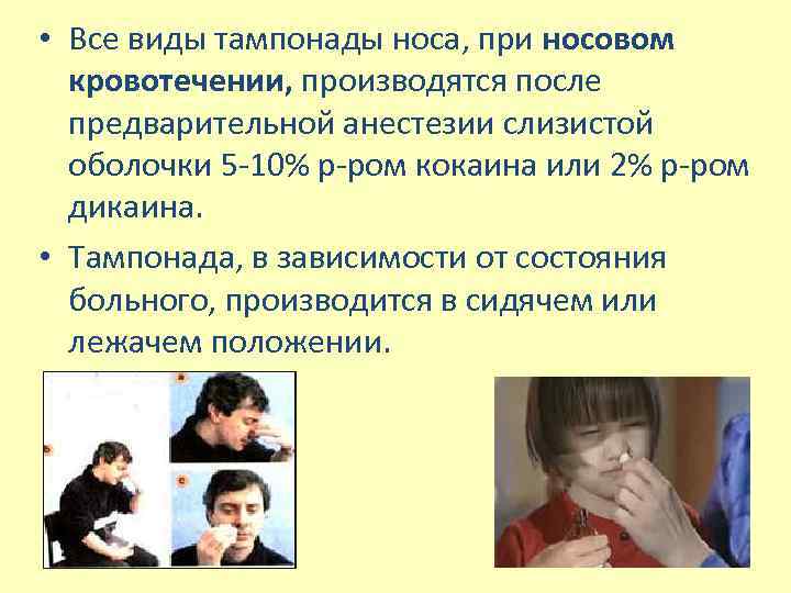  • Все виды тампонады носа, при носовом кровотечении, производятся после предварительной анестезии слизистой