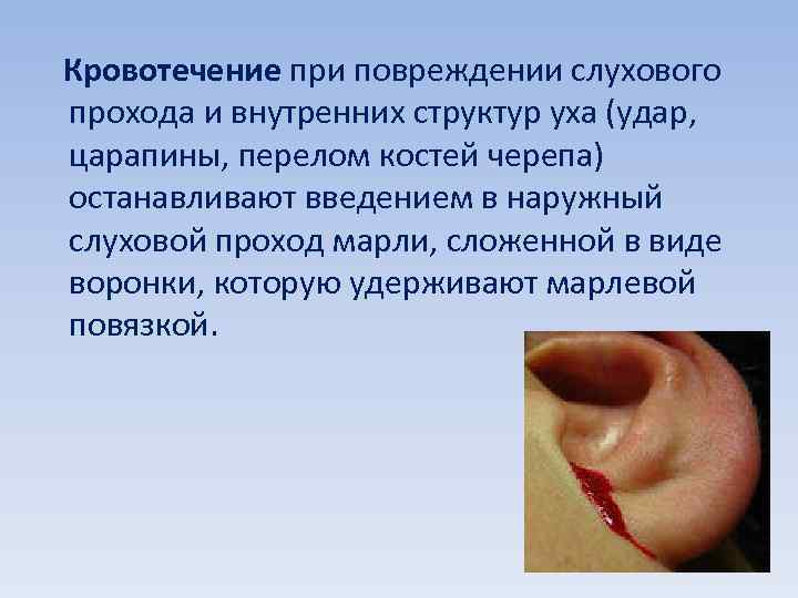 Кровотечение при повреждении слухового прохода и внутренних структур уха (удар, царапины, перелом костей черепа)