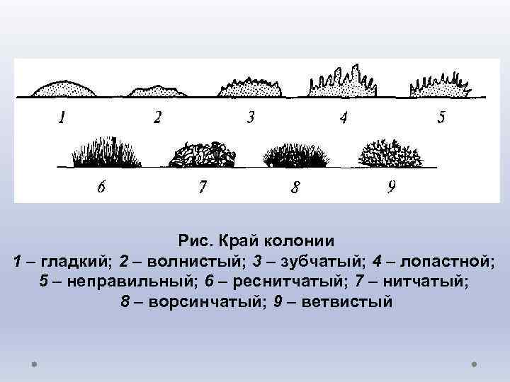Рис. Край колонии 1 – гладкий; 2 – волнистый; 3 – зубчатый; 4 –