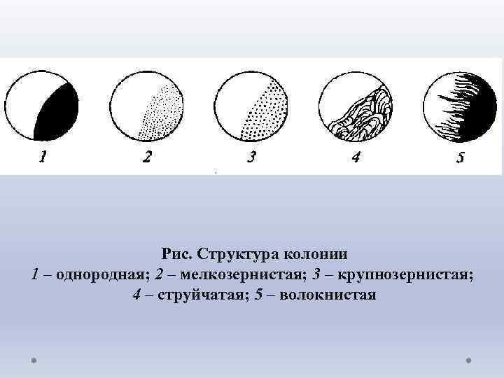 Однородная структура. Структура колоний микроорганизмов. Структура колоний бактерий. Структура бактериальной колонии. Структура колонии.