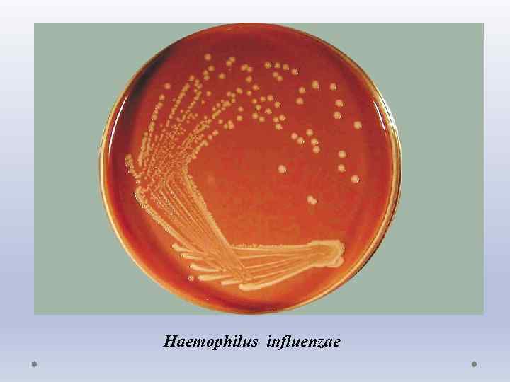 Haemophilus influenzae 