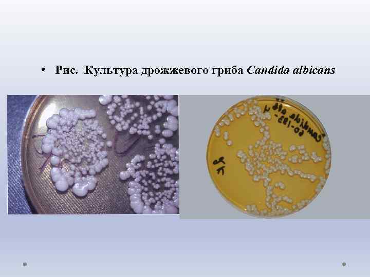  • Рис. Культура дрожжевого гриба Candida albicans 