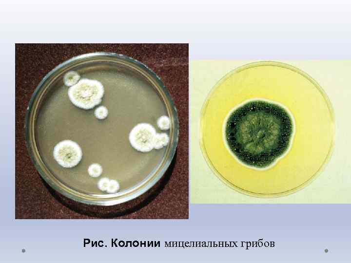 Рис. Колонии мицелиальных грибов 
