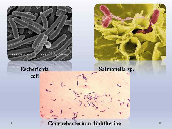 Escherichia coli Salmonella sp. Corynebacterium diphtheriae 