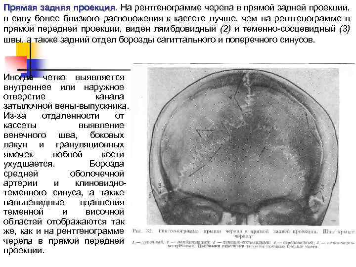 Рисунок пальцевых вдавлений и сосудистых борозд усилен