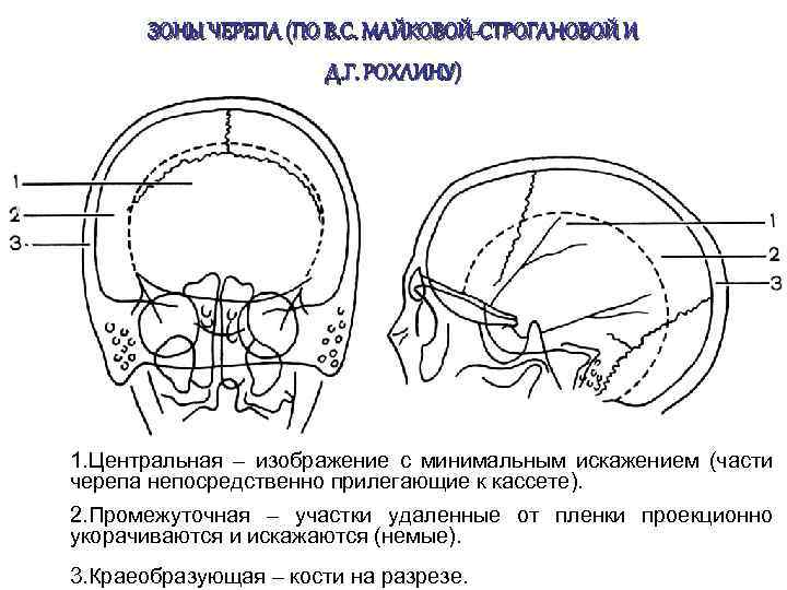 ЗОНЫ ЧЕРЕПА (ПО В. С. МАЙКОВОЙ-СТРОГАНОВОЙ И Д. Г. РОХЛИНУ) 1. Центральная – изображение