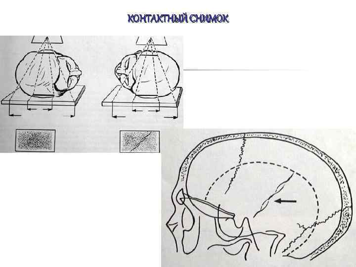 КОНТАКТНЫЙ СНИМОК 