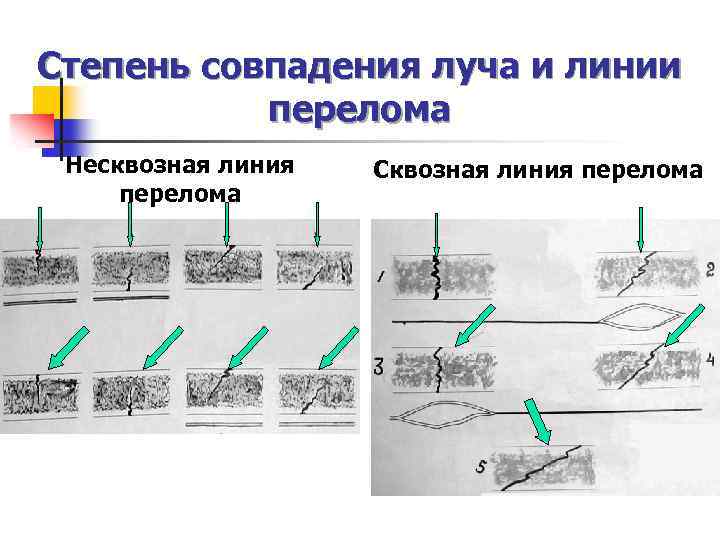 Перелом карта смп