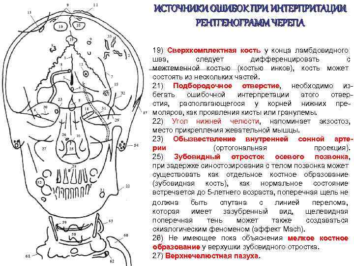 ИСТОЧНИКИ ОШИБОК ПРИ ИНТЕРПРИТАЦИИ РЕНТГЕНОГРАММ ЧЕРЕПА 19) Сверхкомплектная кость у конца ламбдовидного шва, следует