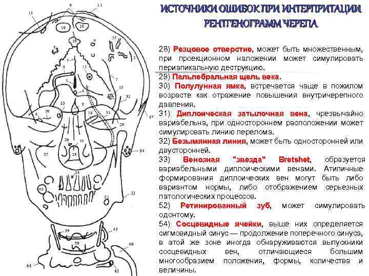 ИСТОЧНИКИ ОШИБОК ПРИ ИНТЕРПРИТАЦИИ РЕНТГЕНОГРАММ ЧЕРЕПА 28) Резцовое отверстие, может быть множественным, отверстие при