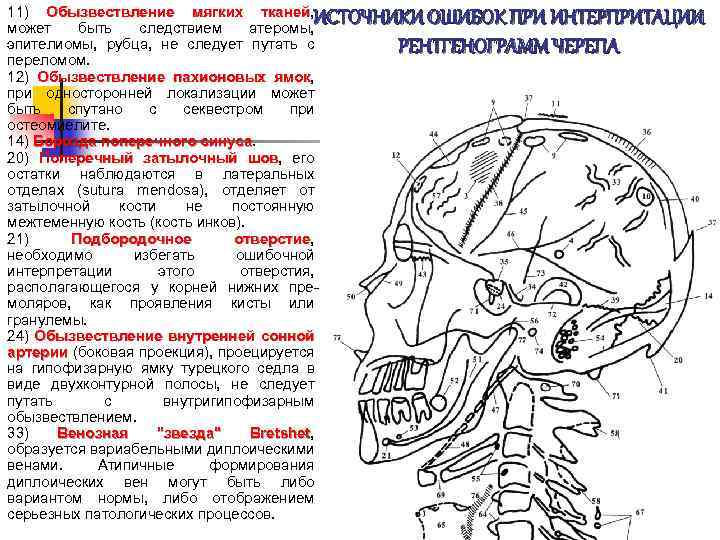 11) Обызвествление мягких тканей, тканей может быть следствием атеромы, эпителиомы, рубца, не следует путать