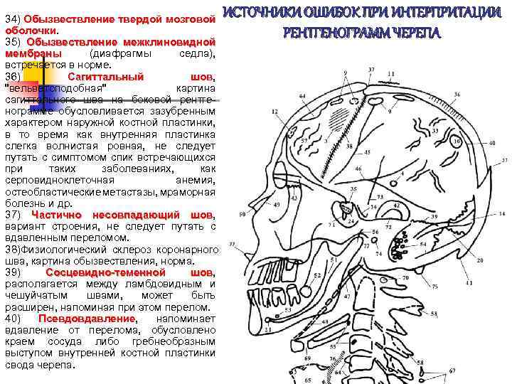 34) Обызвествление твердой мозговой оболочки 35) Обызвествление межклиновидной мембраны (диафрагмы седла), встречается в норме.