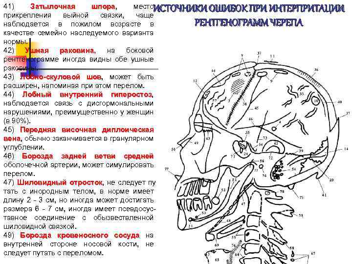 41) Затылочная шпора, место шпора прикрепления выйной связки, чаще наблюдается в пожилом возрасте в