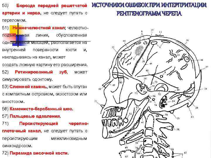 50) Борозда передней решетчатой артерии и нервэ, не следует путать с нервэ переломом. 51)