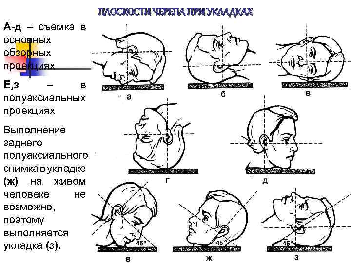 Укладки в рентгенологии в картинках и с описанием для начинающих