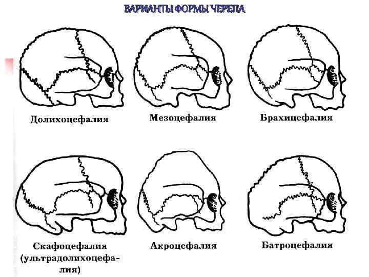 ВАРИАНТЫ ФОРМЫ ЧЕРЕПА 