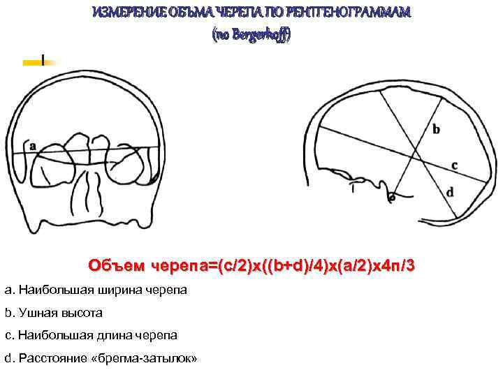 ИЗМЕРЕНИЕ ОБЪМА ЧЕРЕПА ПО РЕНТГЕНОГРАММАМ (по Bergerhoff) Объем черепа=(c/2)x((b+d)/4)x(a/2)x 4 п/3 a. Наибольшая ширина