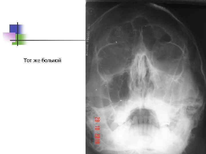 Тот же больной 