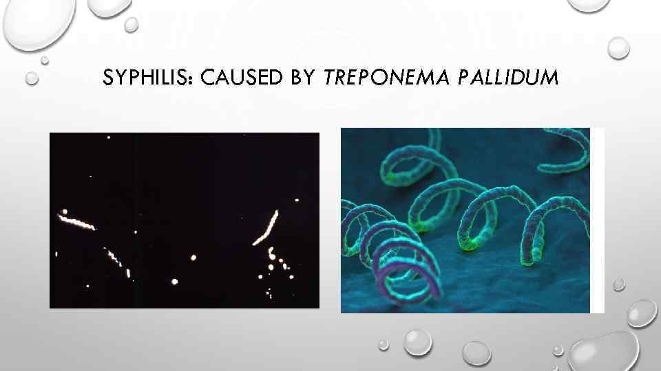 SYPHILIS: CAUSED BY TREPONEMA PALLIDUM 