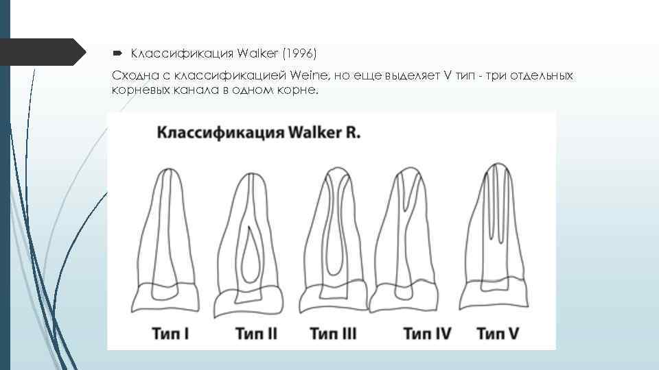  Классификация Walker (1996) Сходна с классификацией Weine, но еще выделяет V тип три