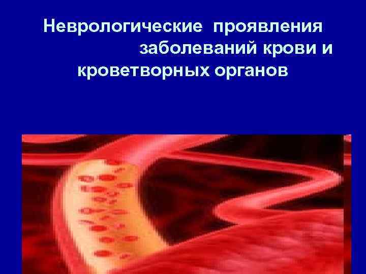 Неврологические проявления заболеваний крови и кроветворных органов 