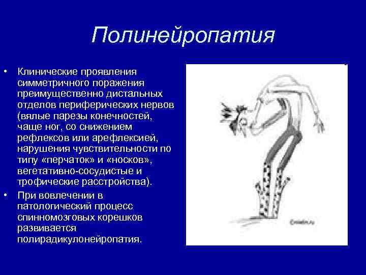 Заболевание полинейропатия конечностей. Полинейропатия клинические проявления. Полинейропатия верхних и нижних. Полиневропатия верхних и нижних конечностей. Полинейропатия нижних конечностей и верхних конечностей.