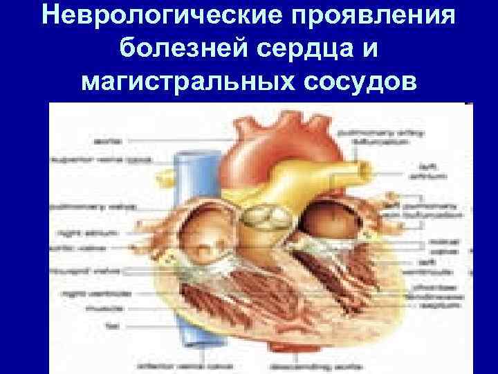 Неврологические проявления болезней сердца и магистральных сосудов 