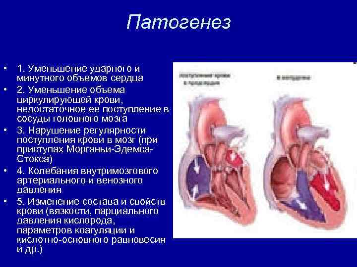 Патогенез • 1. Уменьшение ударного и минутного объемов сердца • 2. Уменьшение объема циркулирующей