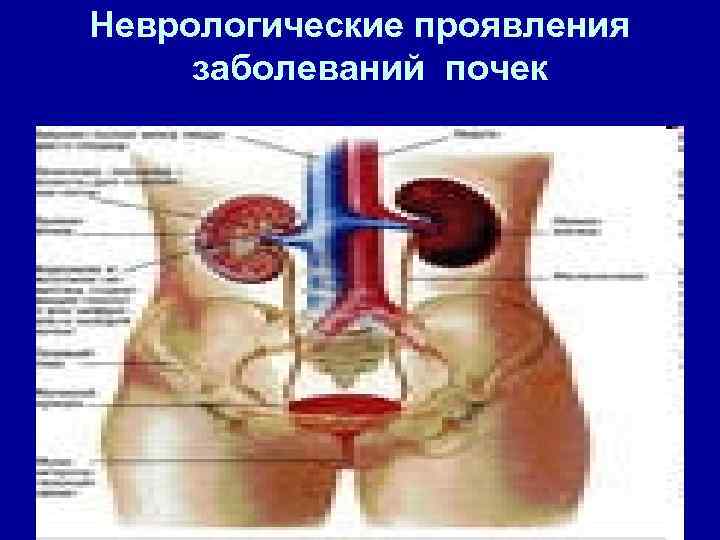 Неврологические проявления заболеваний почек 
